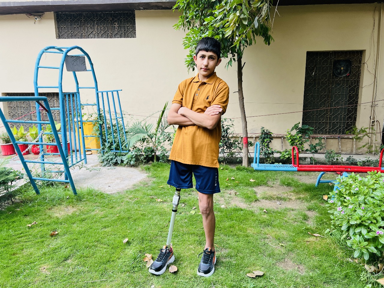 Prosthetic Limbs